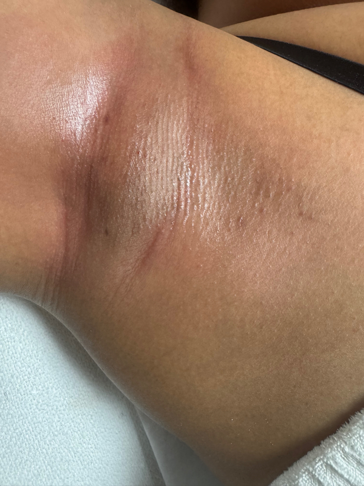 Underarm Wax