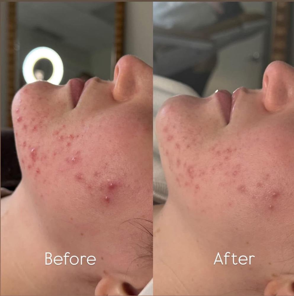 Teen Facial at EmpowerHer Beauty in Zillah, WA