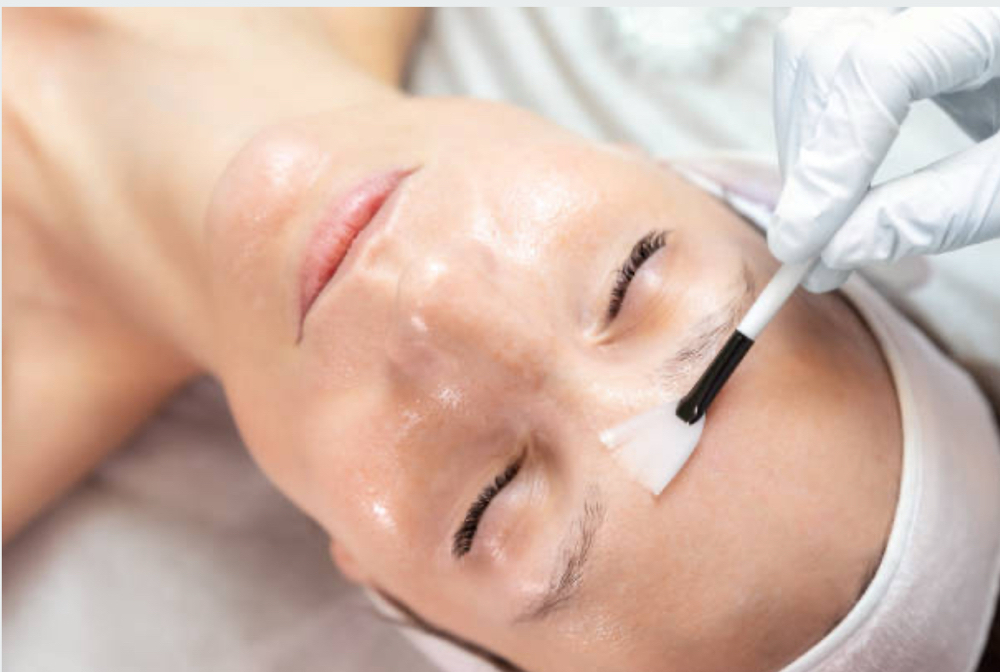 Pro-Aging Floraessence Peel
