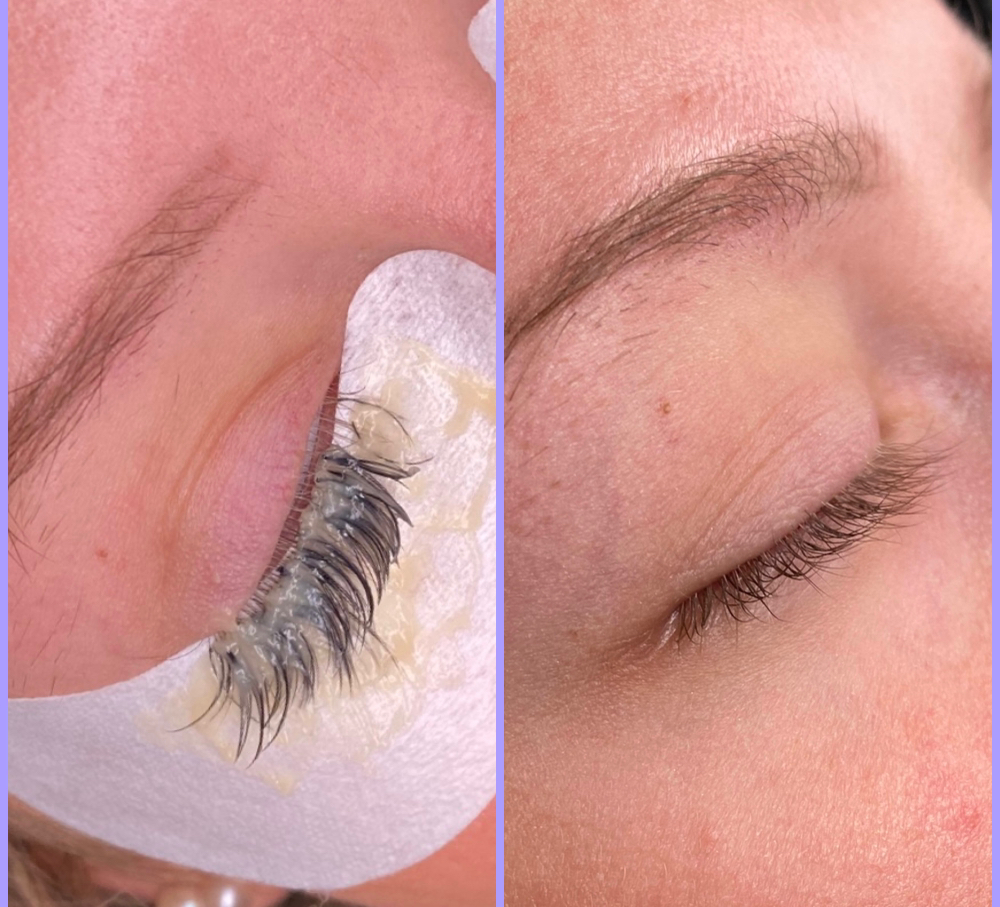 Lash Extension Removal