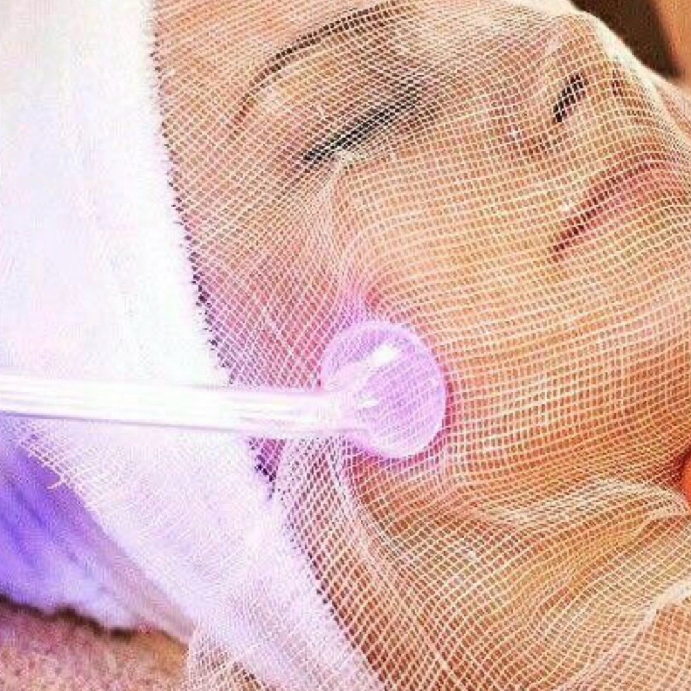 Add on High Frequency at SkinByIzabella in Toledo, OH