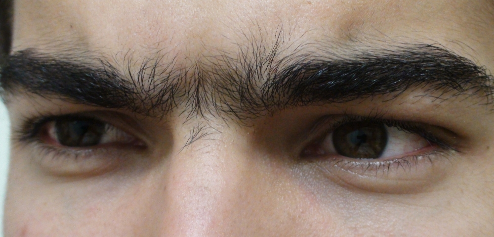 Middle Brow