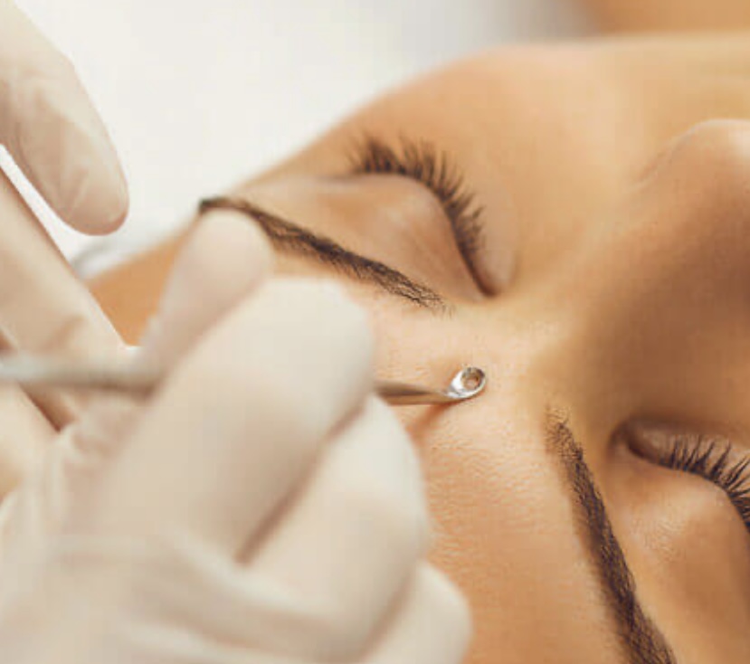 Extractions Facial Add-on