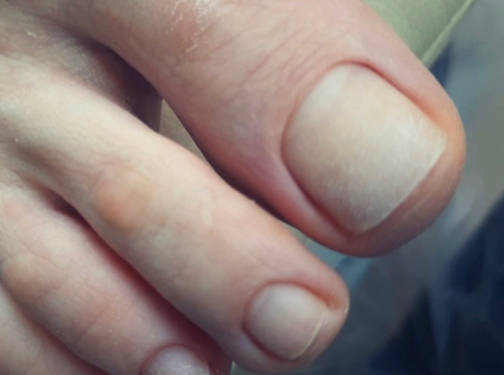 No polish pedicure