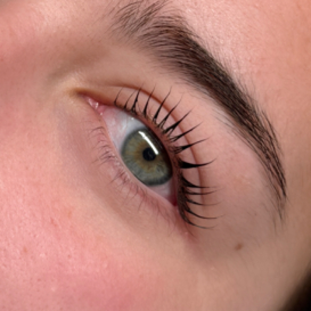 Villa Lift & Tint at Villa Esthetics in Bryan, TX