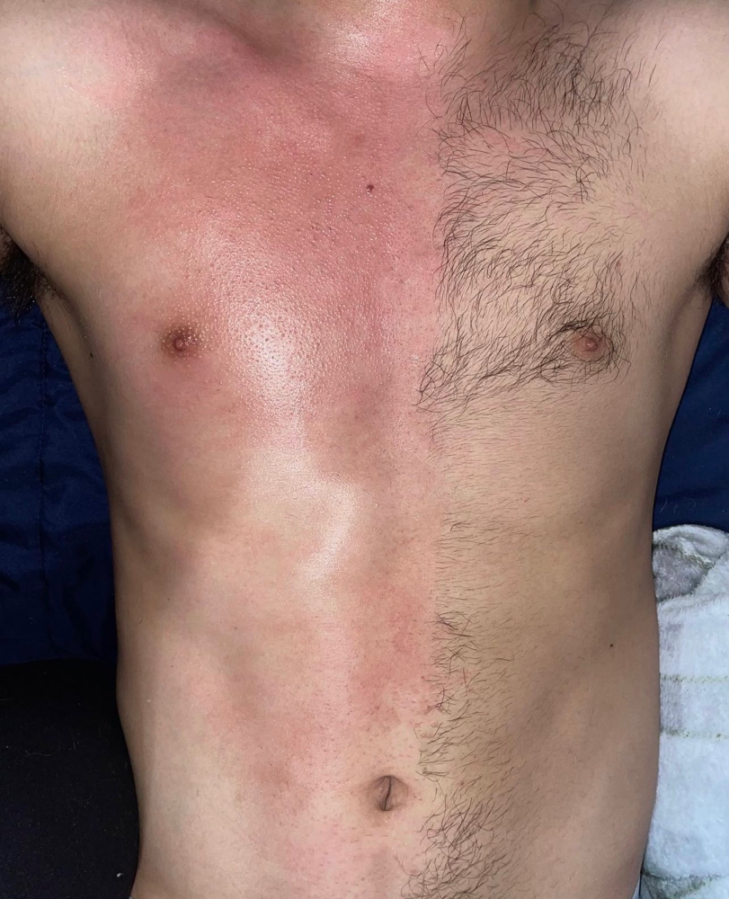 Chest Wax