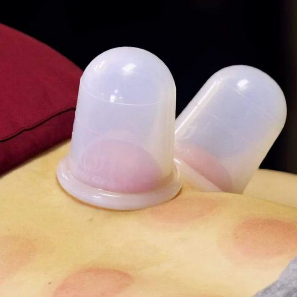 Cupping - Stand Alone Add On at Somatic Massage & Bodywork By Jess in Lexington, KY