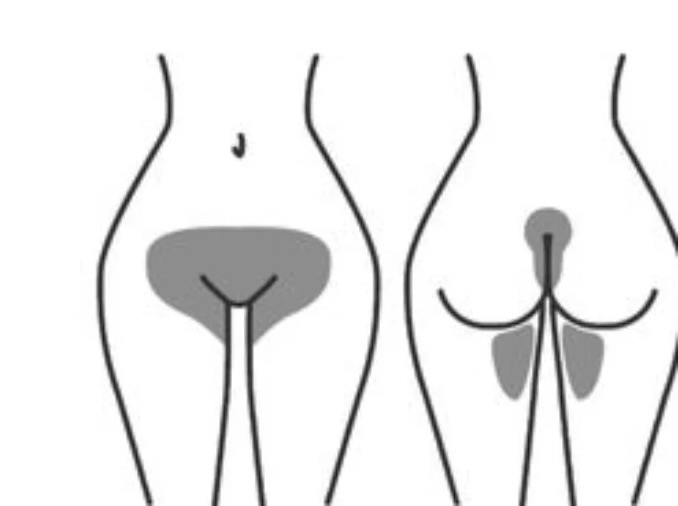 Brazilian Wax (Female Only)