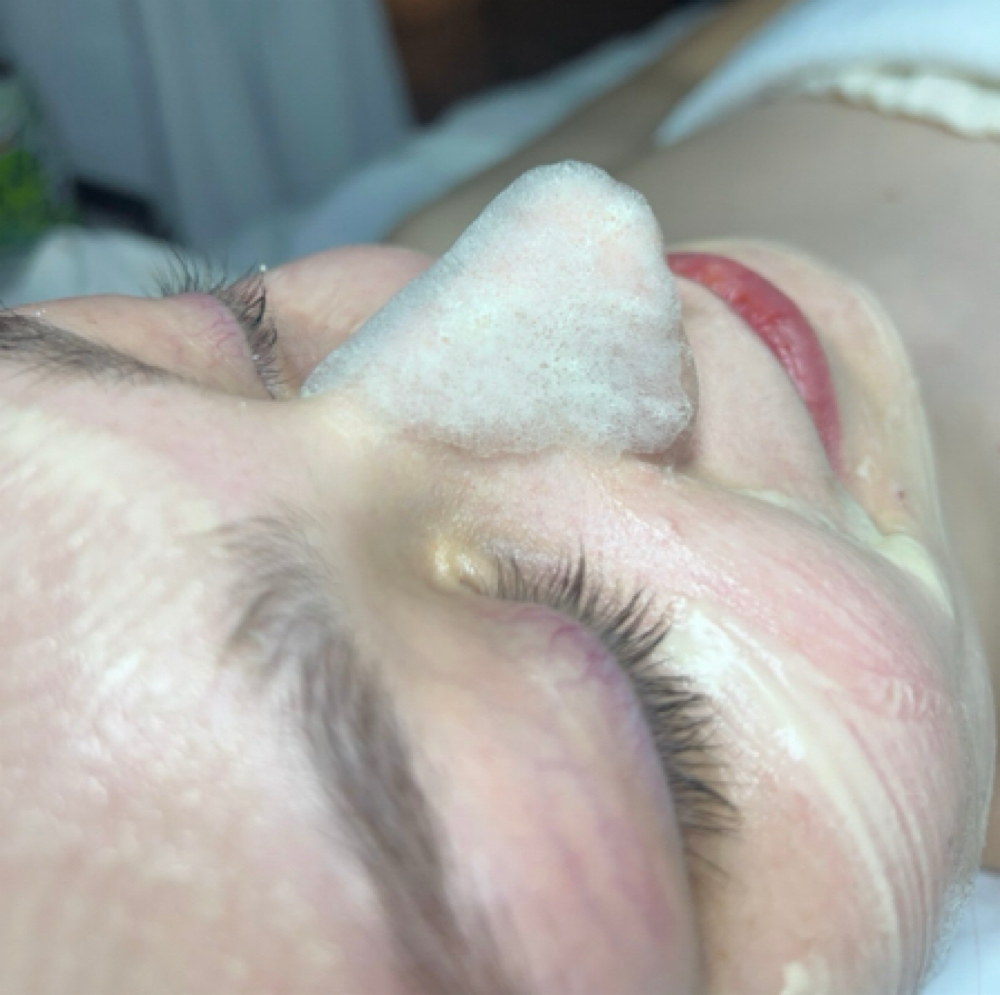 Taylor’d Custom Facial at Pure Aesthetics and Wellness LLC in Leitchfield, KY