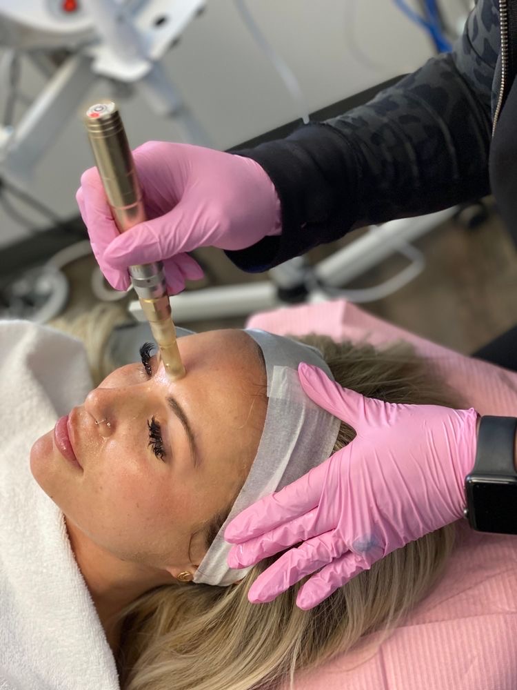 Facial With Dermapen
