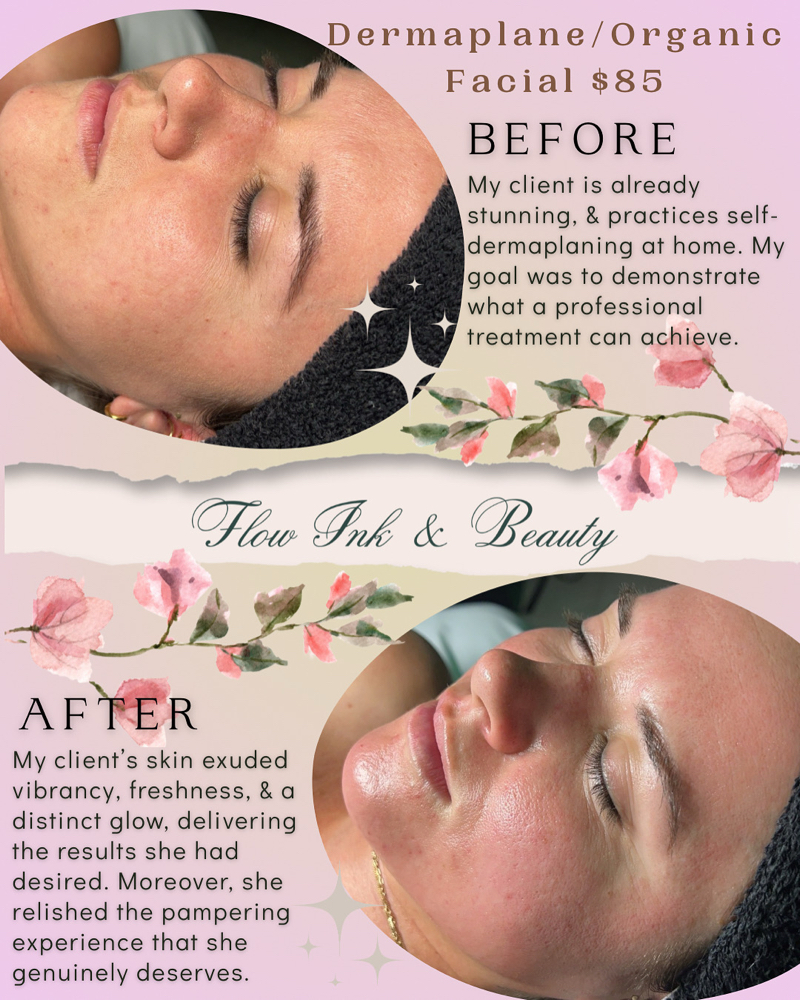 Facials