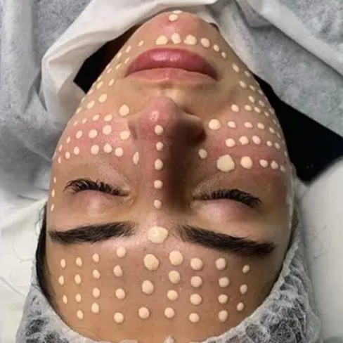 Korean BB Glow Facial at Royal Esthetics & Wellness in Oro Valley, AZ