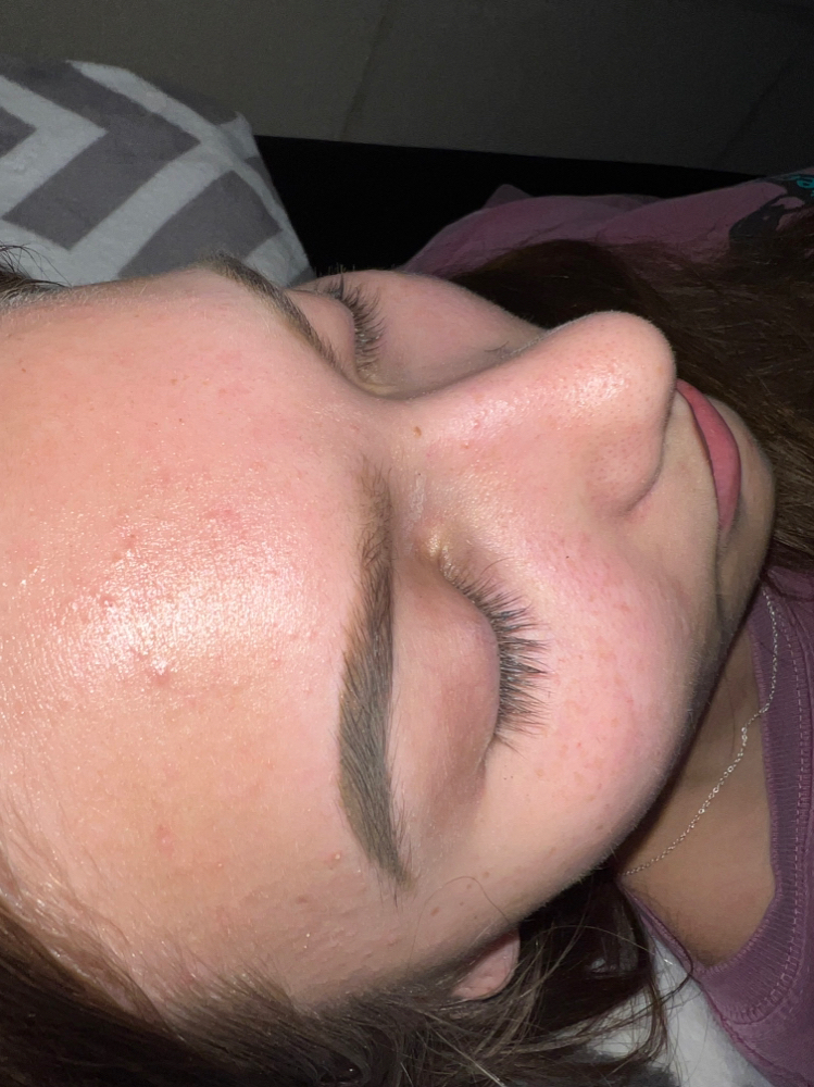 Lash Removal