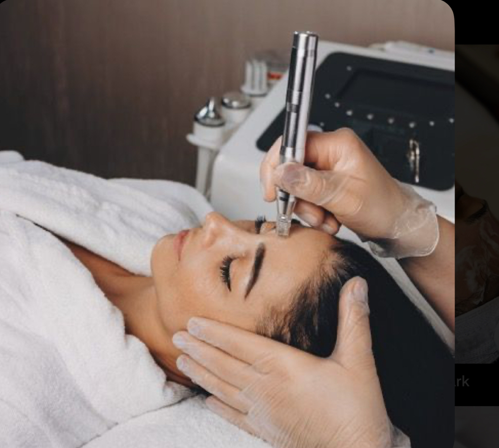 Microdermabrasion Facial
