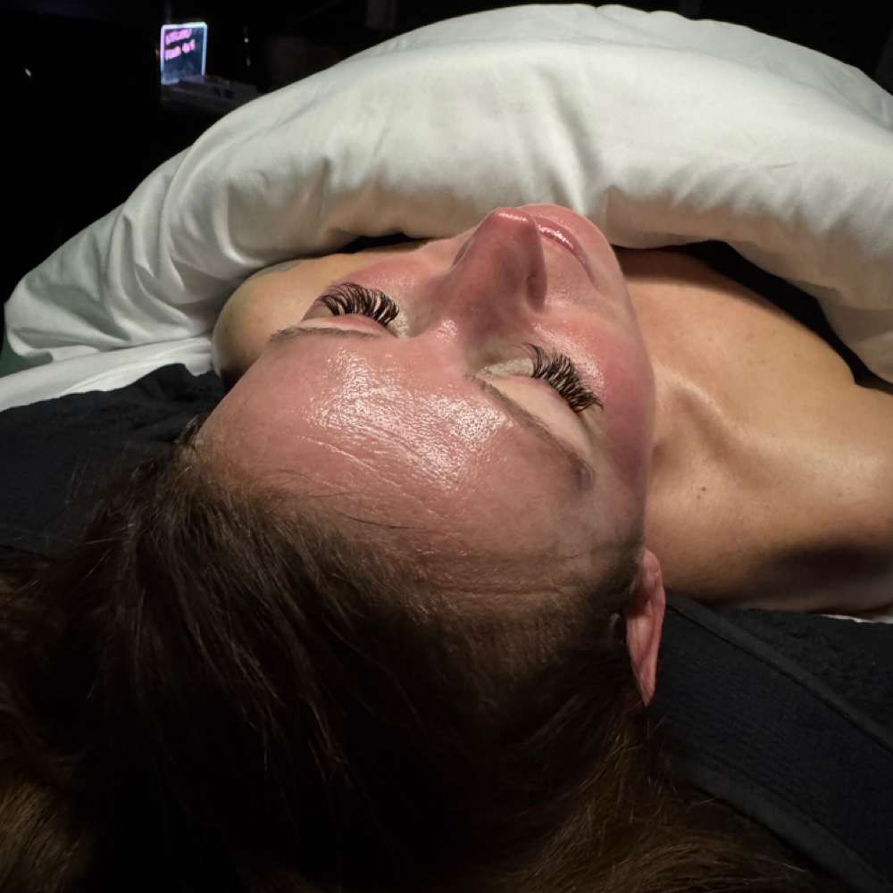 Microneedling at The Proverbs Studio in Bessemer City, NC