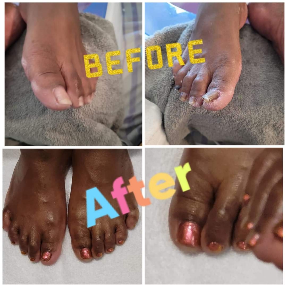 Medi PEDICURE