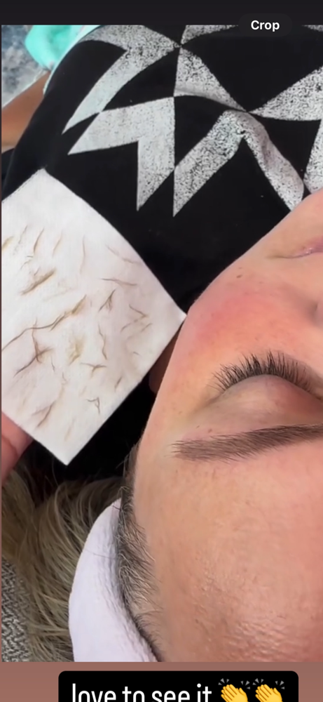 Dermaplaning Facial
