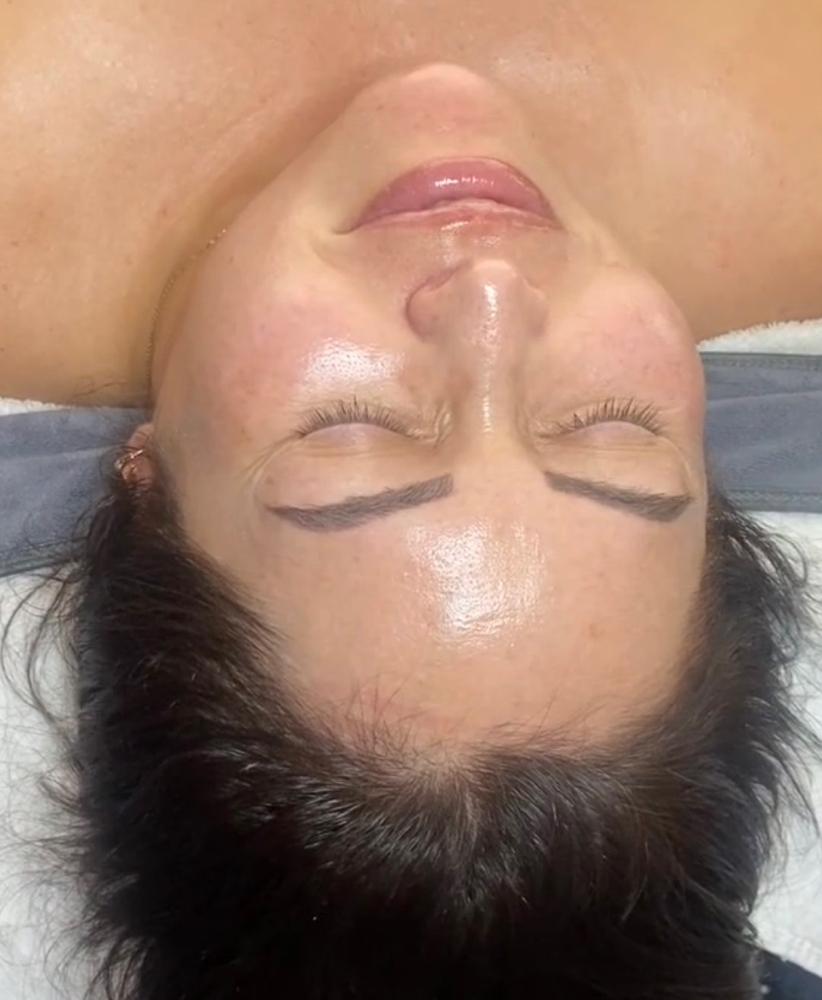 Dermaplane Facial