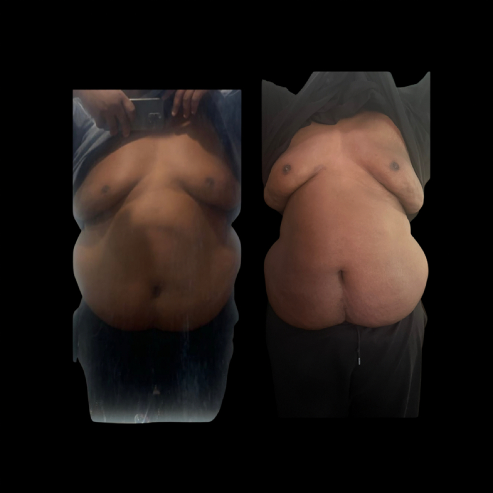 Peptide Detox Follow Up at Changes Beaute Lounge LLC in Stockton, CA