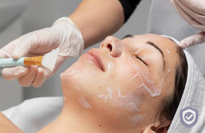 Chemical Peel