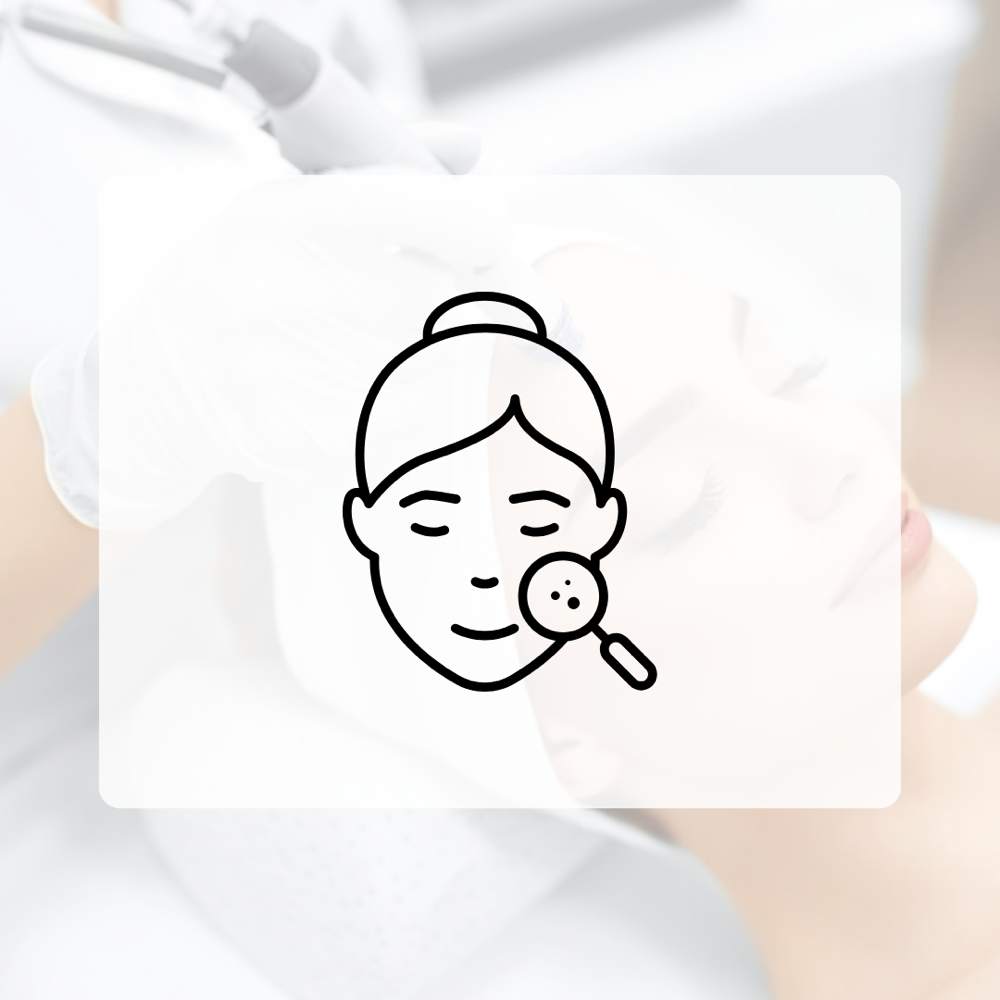 Clarifying Acne Facial at Self Cary in Fort Washington, PA