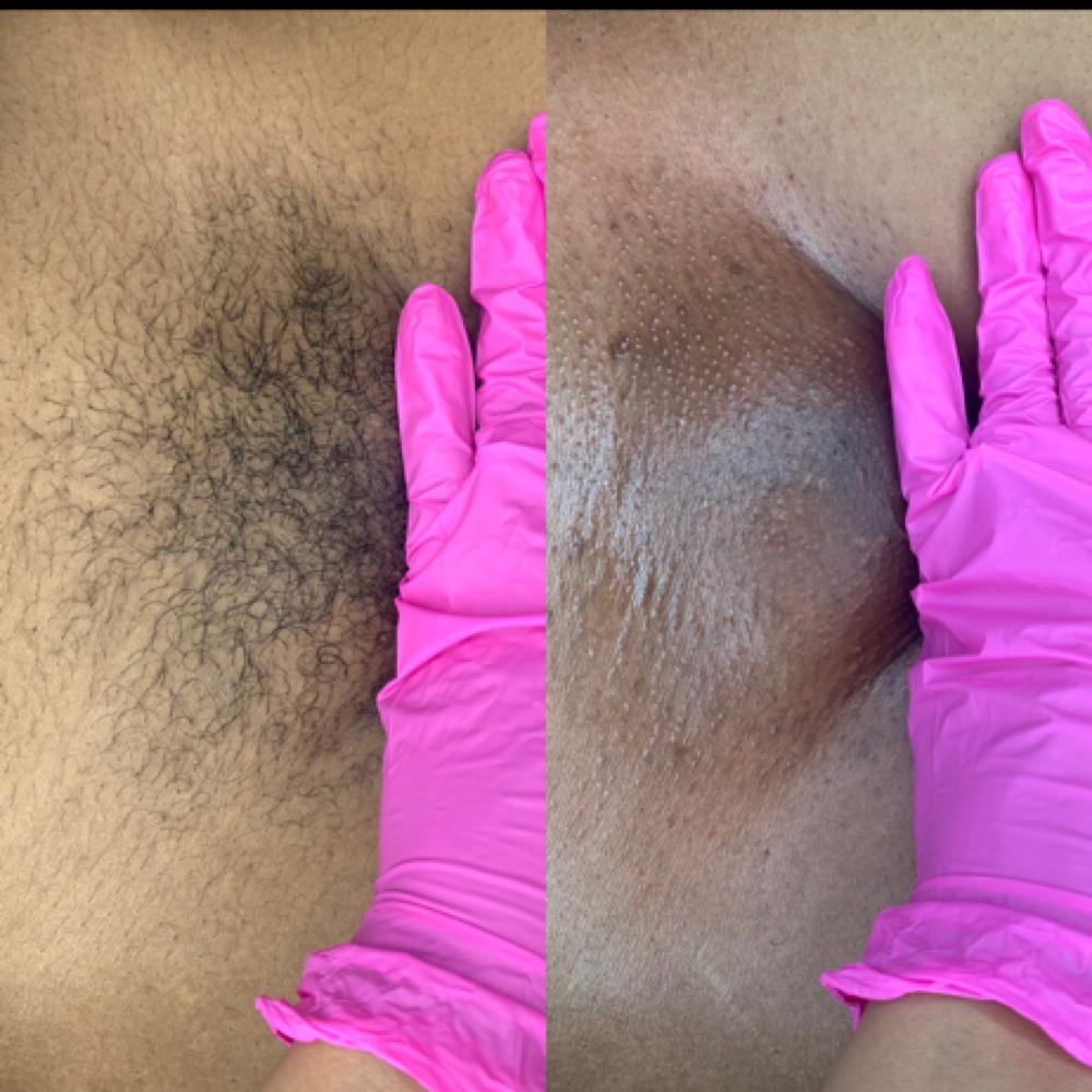 Brazilian at Beauty Glow in Columbia, MO