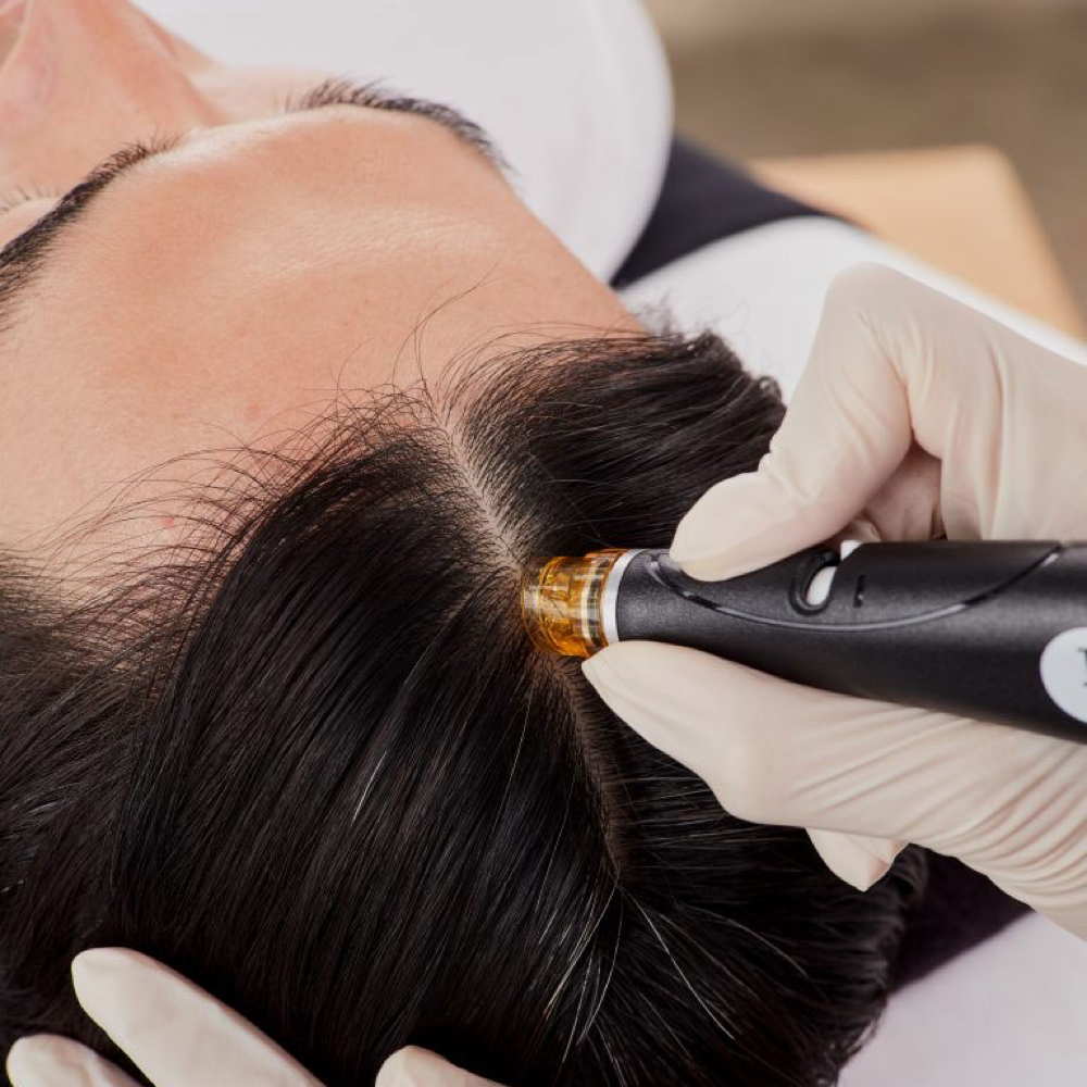 HydraFacial Keravive Scalp at Alchemy Skin Lab in Tualatin, OR