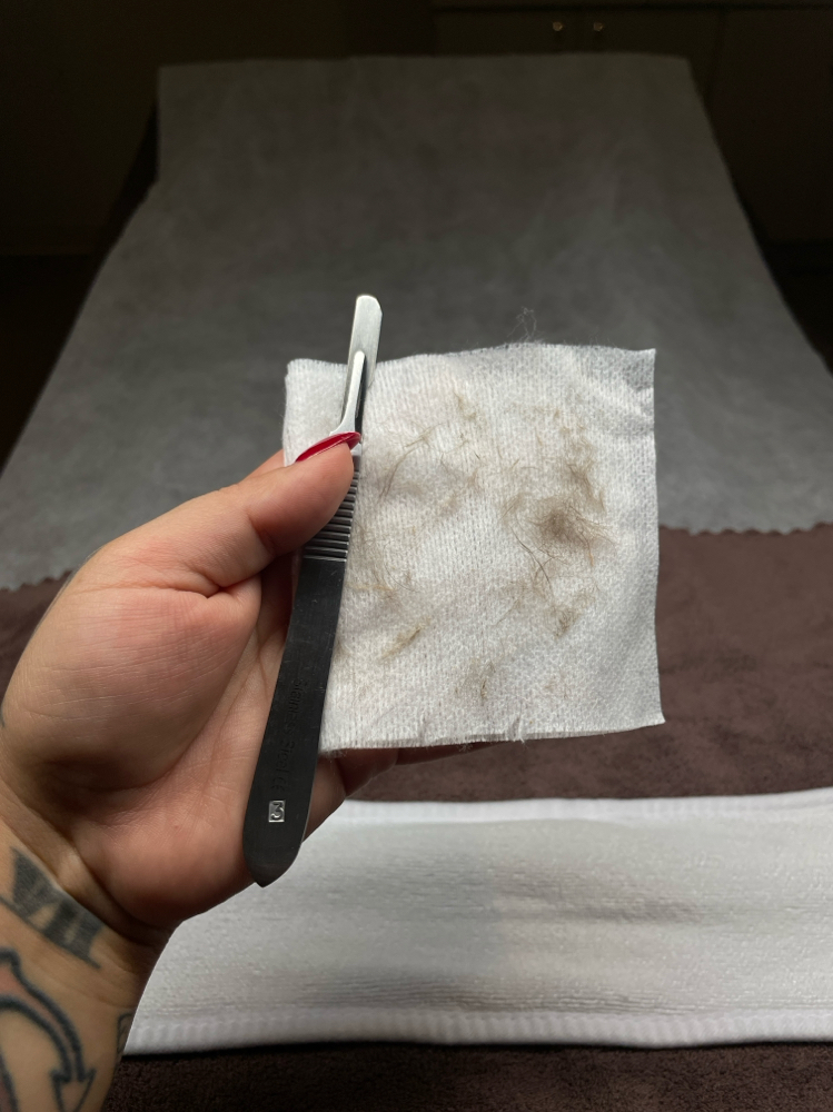 Dermaplaning ONLY at VanessasSkinStudio in Houston, TX