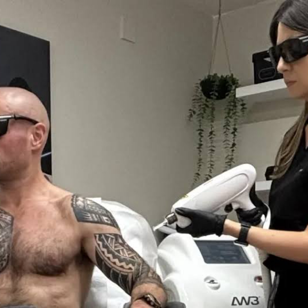 Large Tattoo Removal at Cedar & Sage Aesthetics & Wellness in Hiawassee, GA