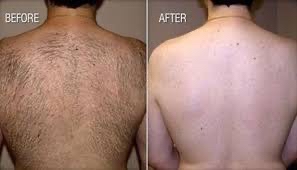 Full Back Wax