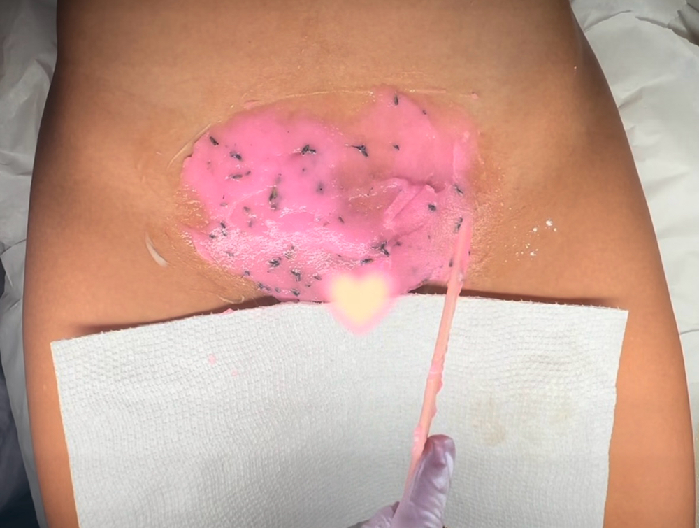Brazilian Wax + Hydrojelly Mask
