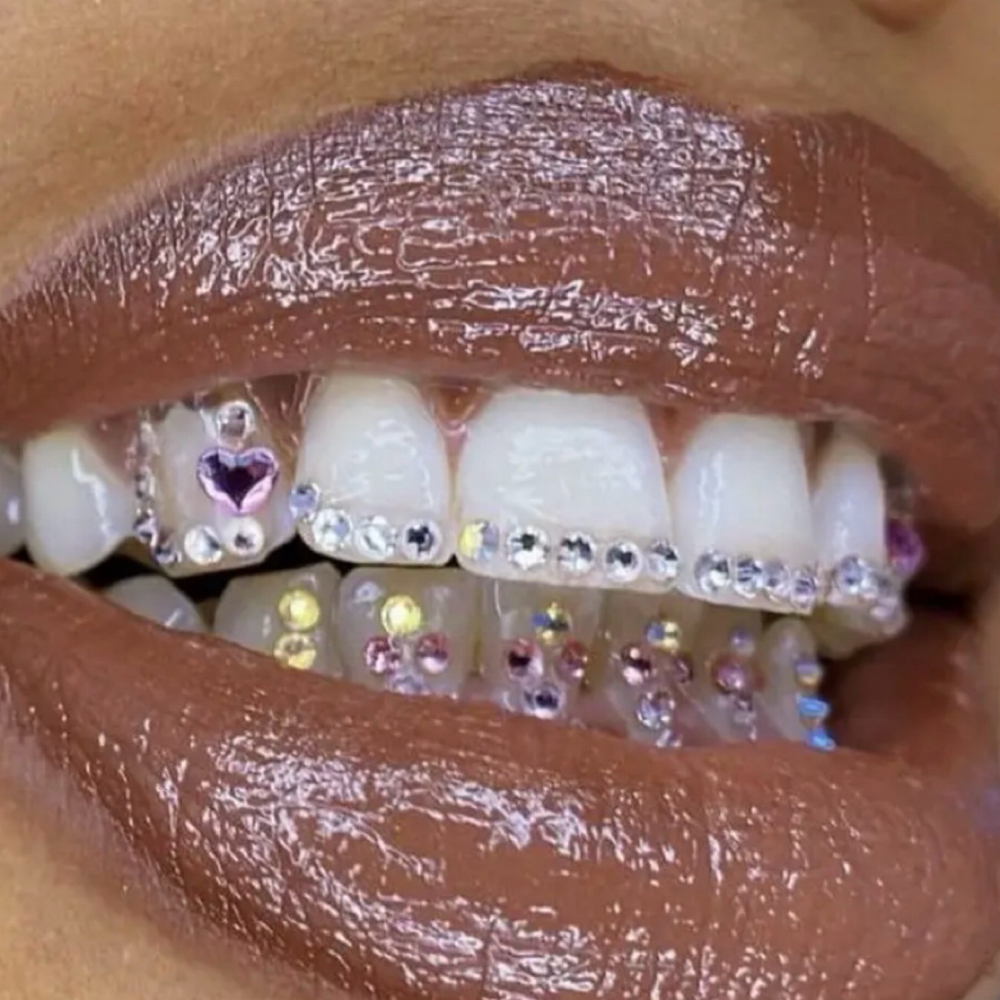 Havynn Smile Gems 💎 Custom Grill at The Havynn For Beauty in Colorado Springs, CO