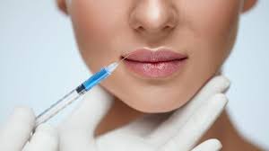 Lip Filler Half Syringe