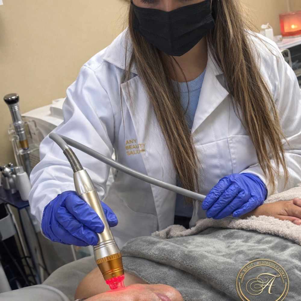 Radiofrecuencia Fraccionada/M8 at Any Beauty Aesthetics Care in New York, NY