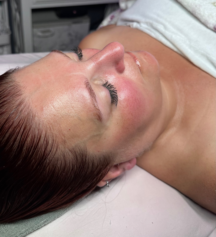 Hydrofacial