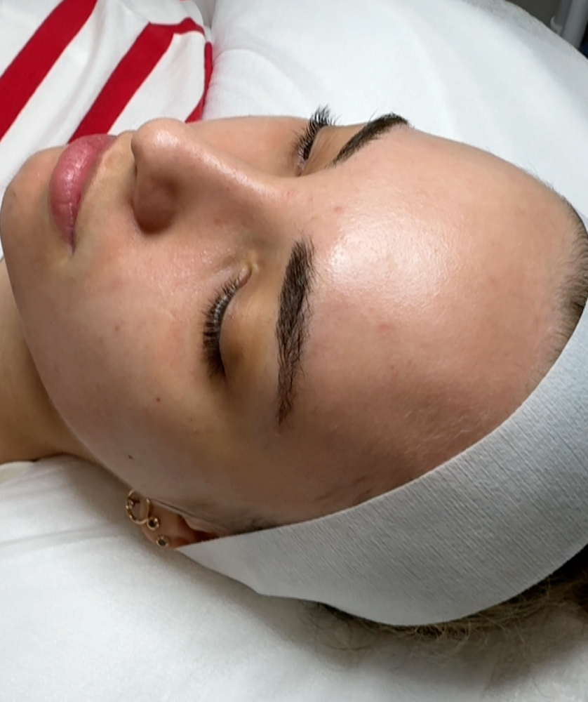 Face Reality Rosacea facial