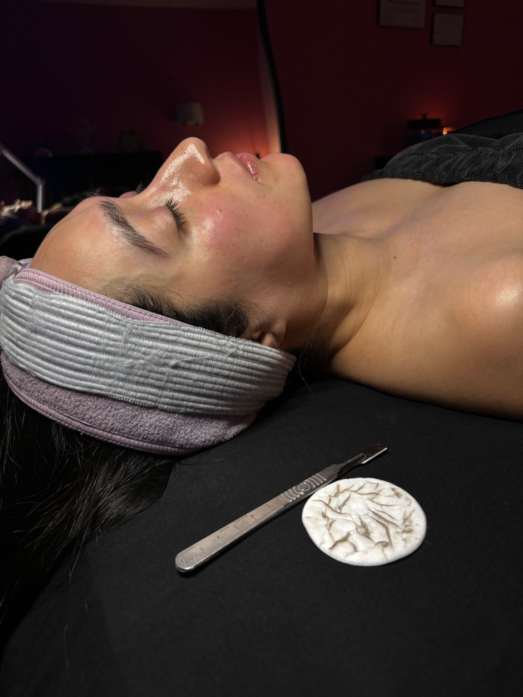 Dermaplaning