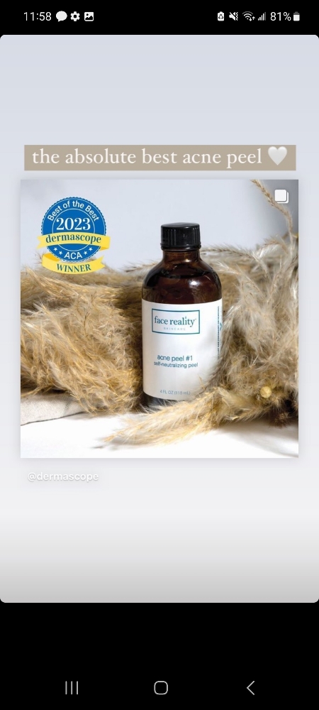 Acne Treatment