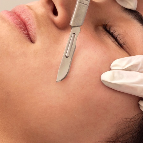 Velvet Skin Dermaplaning Express at Boss Skin Method in New Rochelle, NY