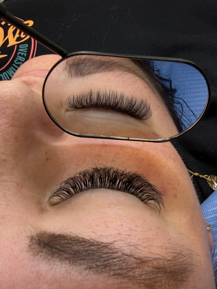 Hybrid full set at PRESTHETICS in tuttle, OK