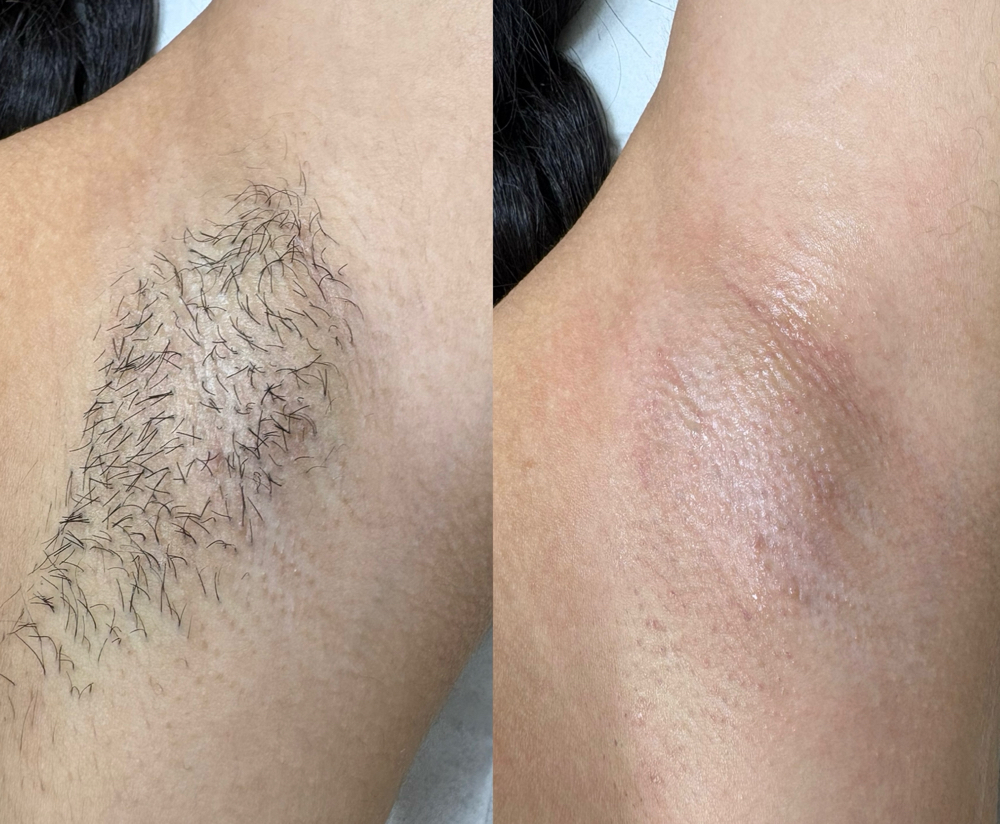 Underarms Wax