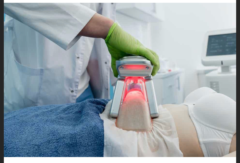 Cryo Body Sculpting