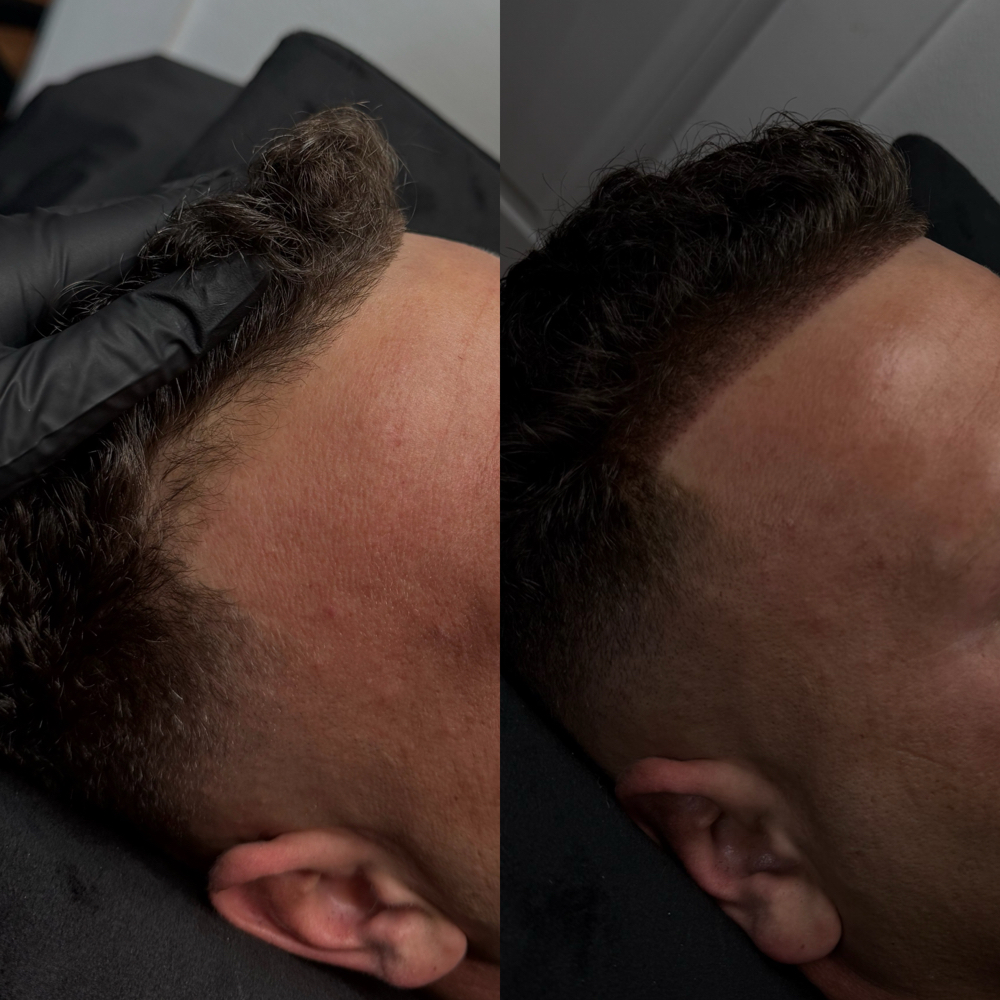 Scalp Micropigmentation- SMP at Looks With Lyss in Laplace, LA