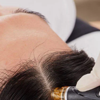 Keravive Scalp Crown at Quiet Beauty Spa in Newport Beach, CA