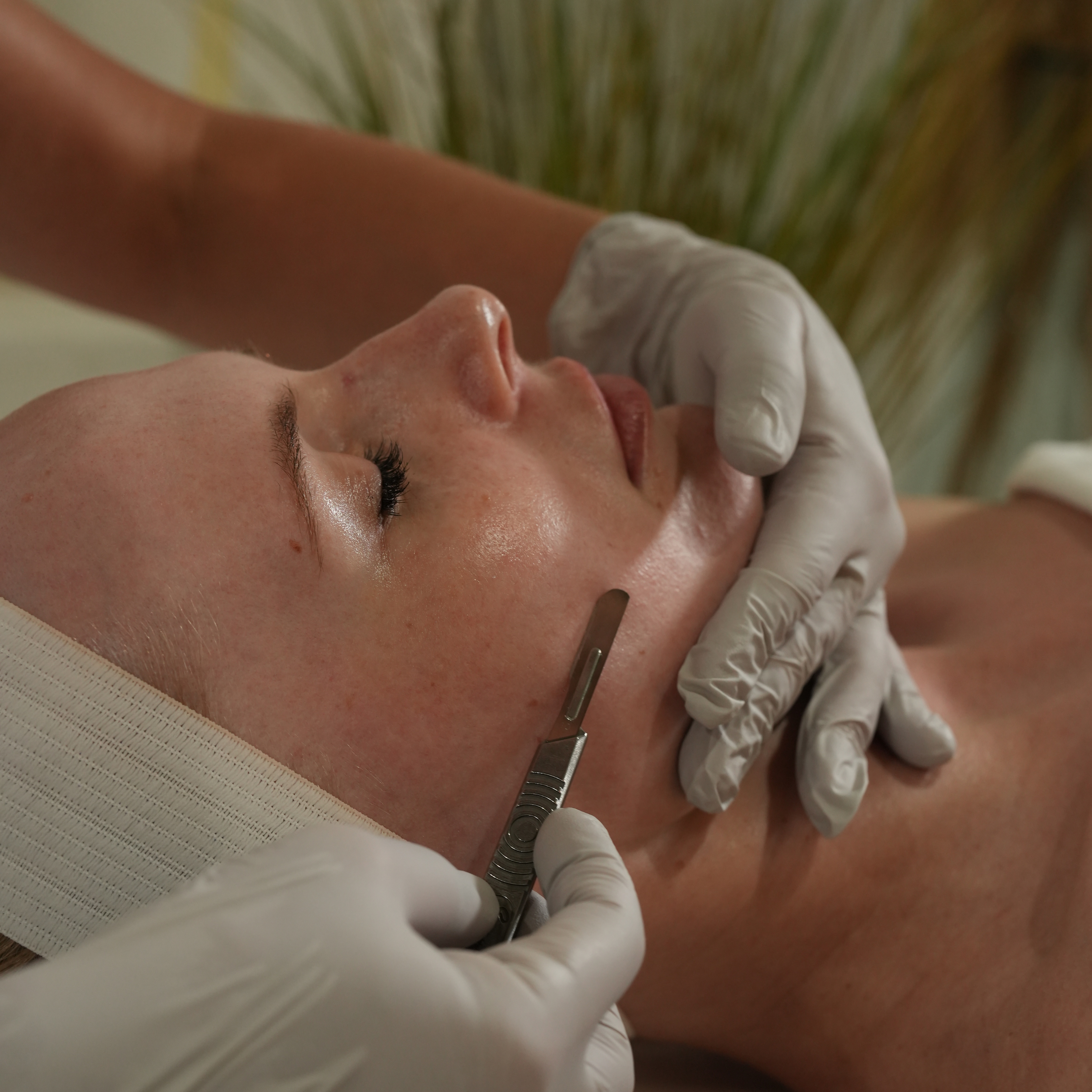 Dermaplaning at PolinaSerene in Tenafly, NJ