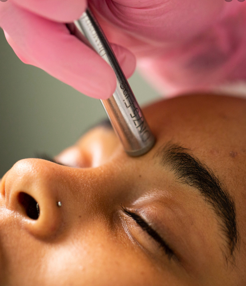 Microdermabrasion Facial