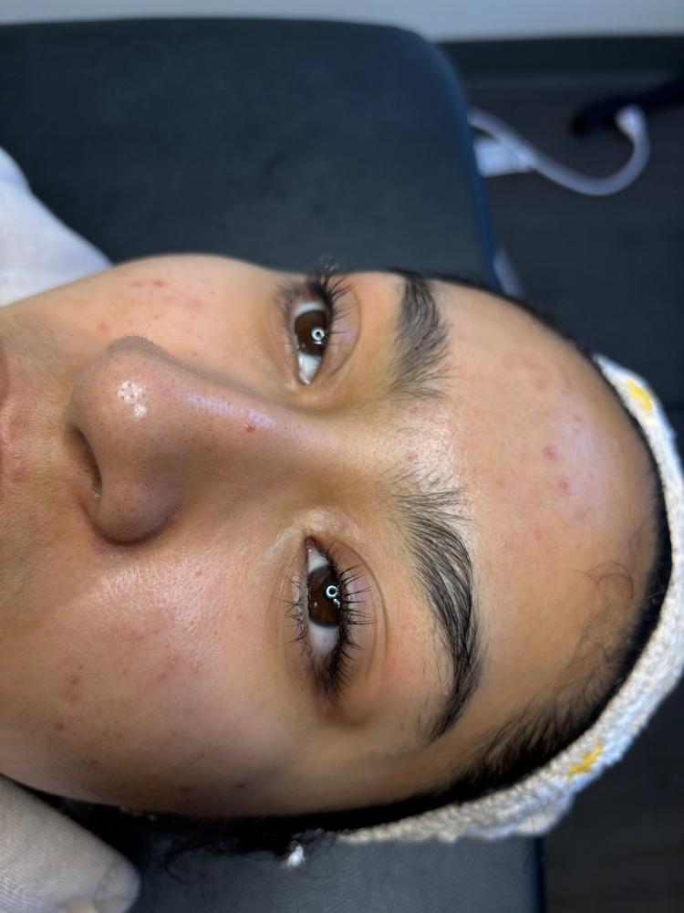 Lash Lifting