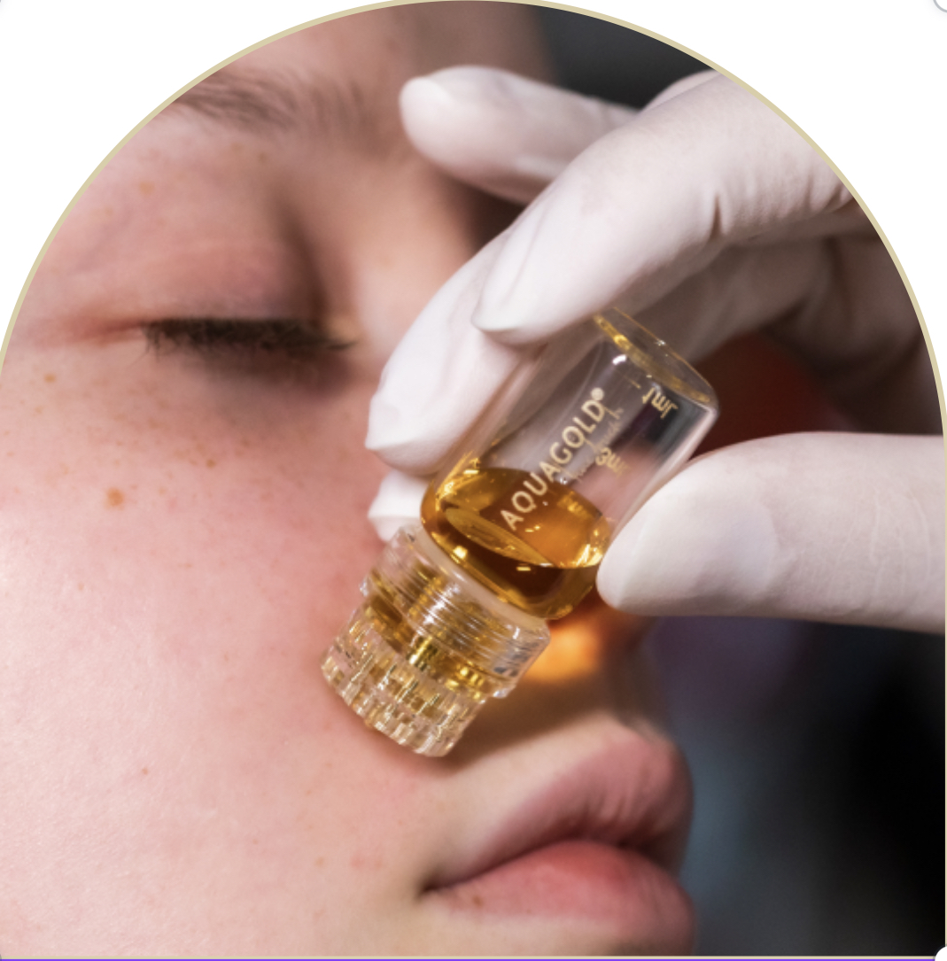 Micro-Infusion / Aquagold Facial at Skin & Beauty Aesthetics Studio in New York, NY