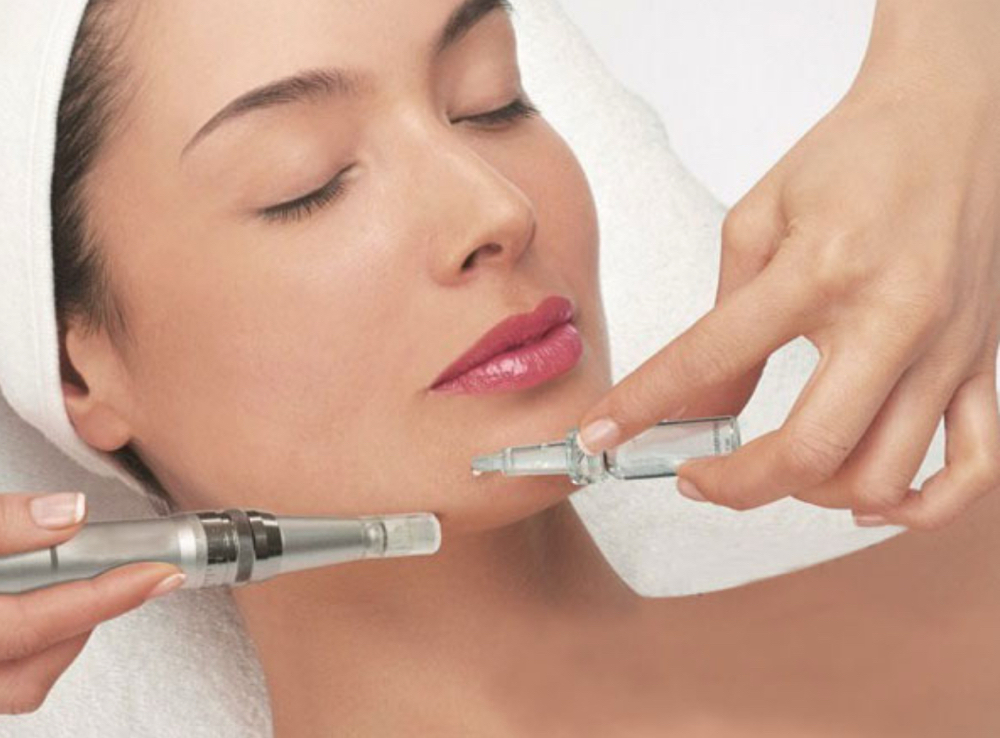 BIOREPEEL + MICRONEEDLING