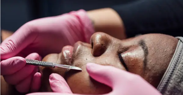 Dermaplaning